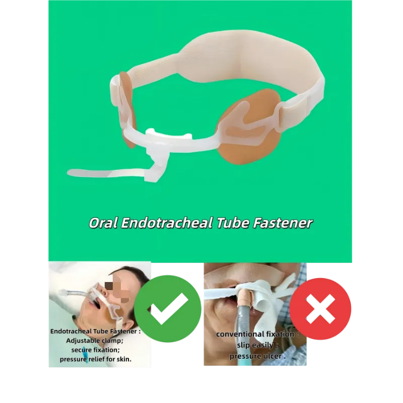 ตัวยึดท่อช่วยหายใจ