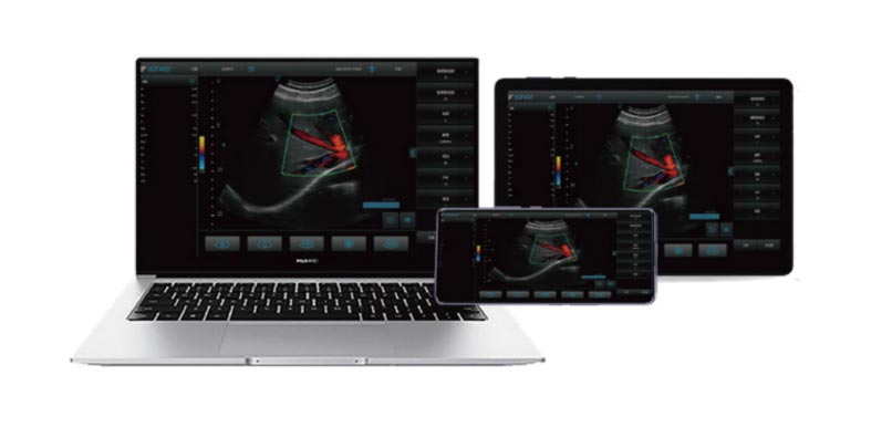 Handheld Ultrasound Machine