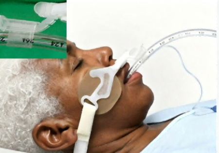 oral endotracheal tube fastener