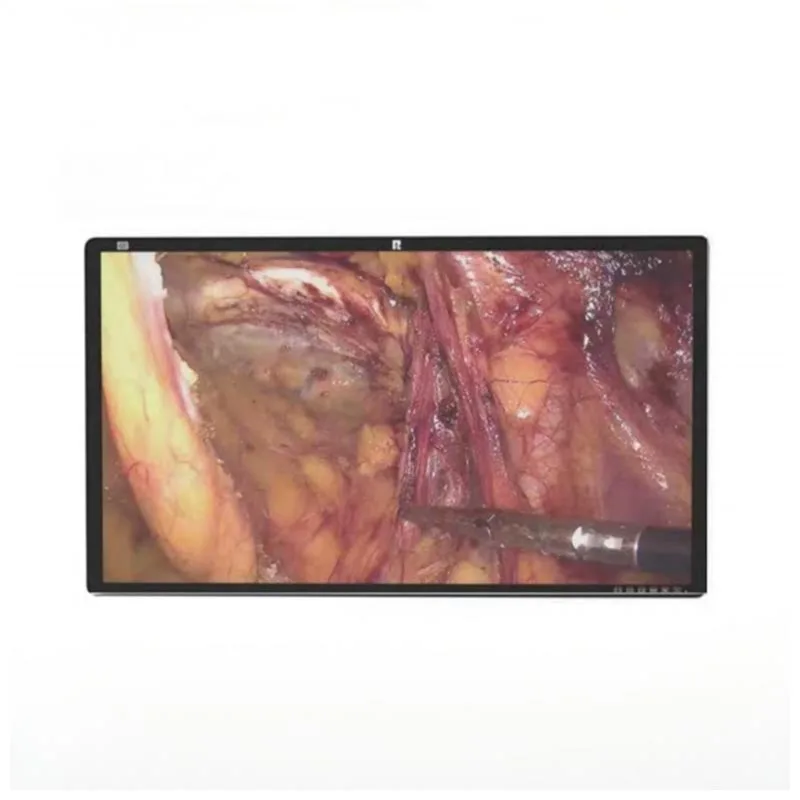 55-inch 4K Surgical Medical Monitor
