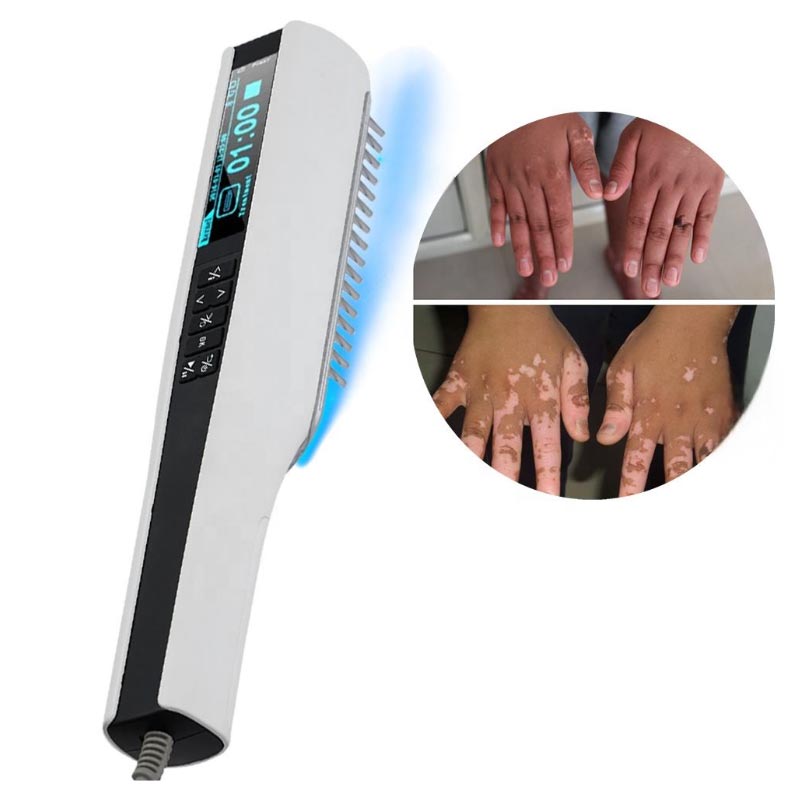 อุปกรณ์ส่องไฟอัลตราไวโอเลต